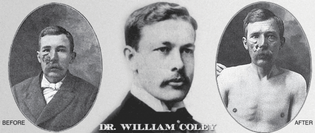 Dr William Coley - Sarcoma Treatment